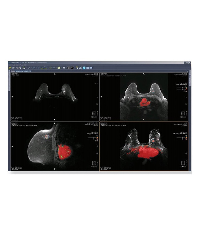 Hologic Miniview HOLOGIC – MultyView Software | Fiba Medical